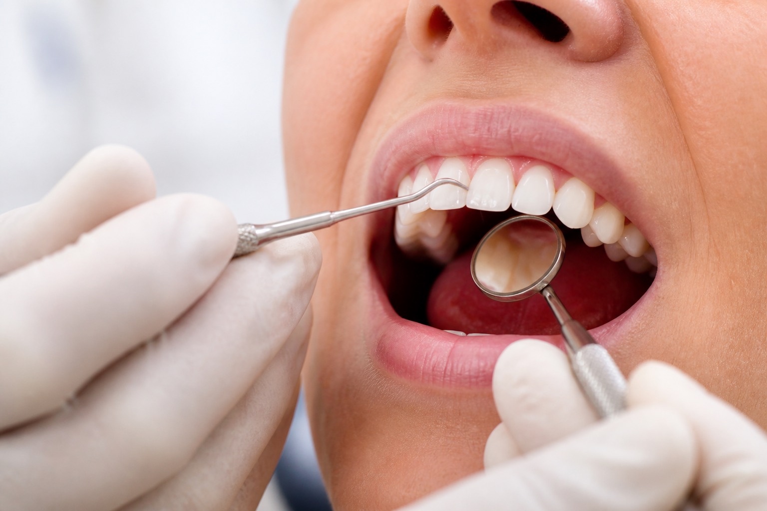 Tratamiento de periodoncia y salud de encías